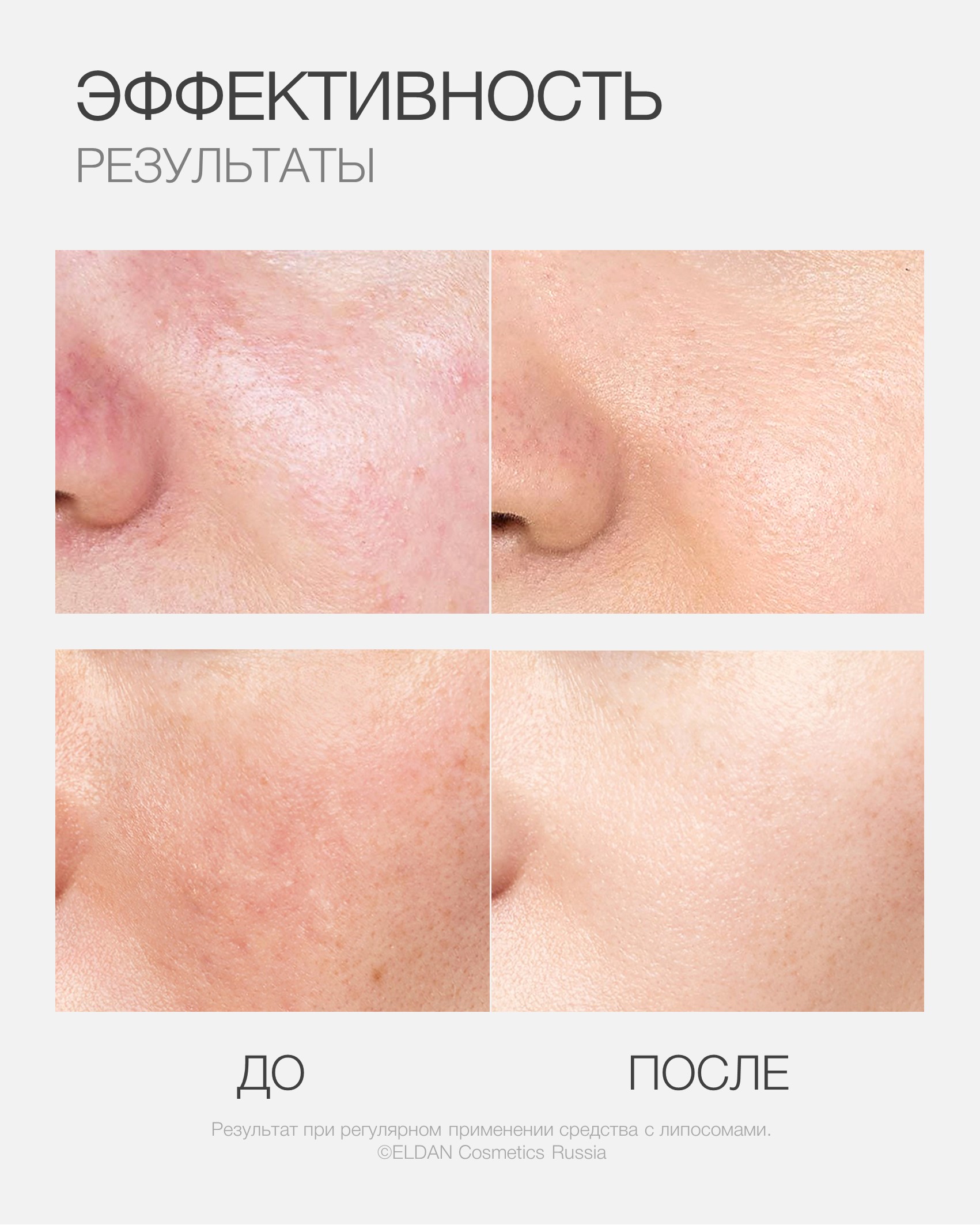 Пост липосомы 4 (25).jpg